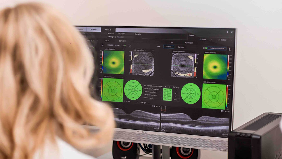 OCT – optička koherentna tomografija