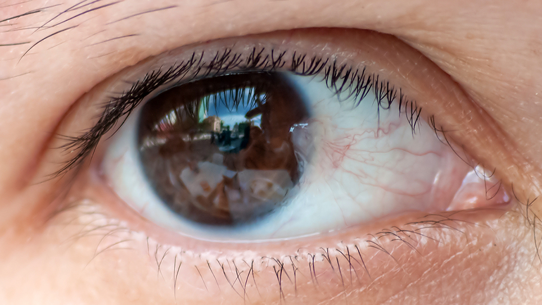 Pterigijum (pterygium)